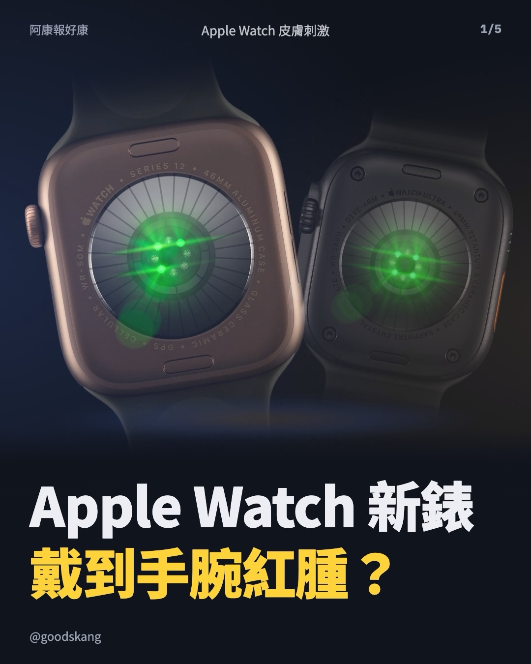 Apple Watch 新錶,戴到手腕紅腫?先別硬撐著「適應」。